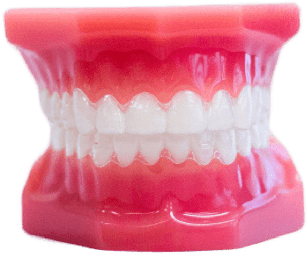 invisalign aligners on model